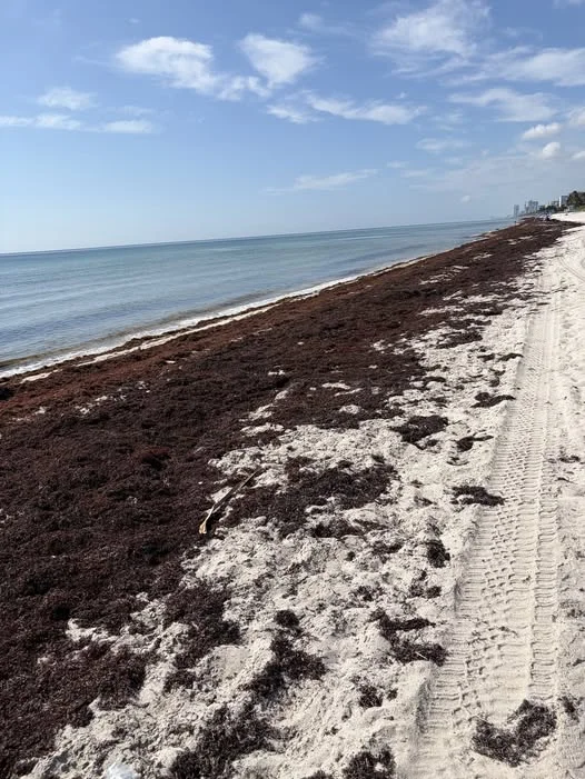 HOLLYWOOD BEACH TODAY (8/20/26) . from Dania Beach to Hallandale Beach. That really sucks!